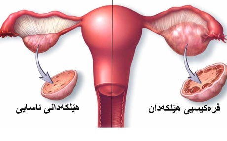 وردەکیسی هێلکەدان